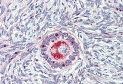 TM9SF1 Antibody, Novus Biologicals 50 &mu;g; Unconjugated:Antibodies, Polyclonal